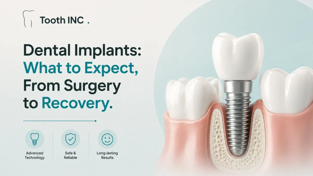 Dental Implants: What to Expect, From Surgery to Recovery 1 Dental Implants Chandigarh