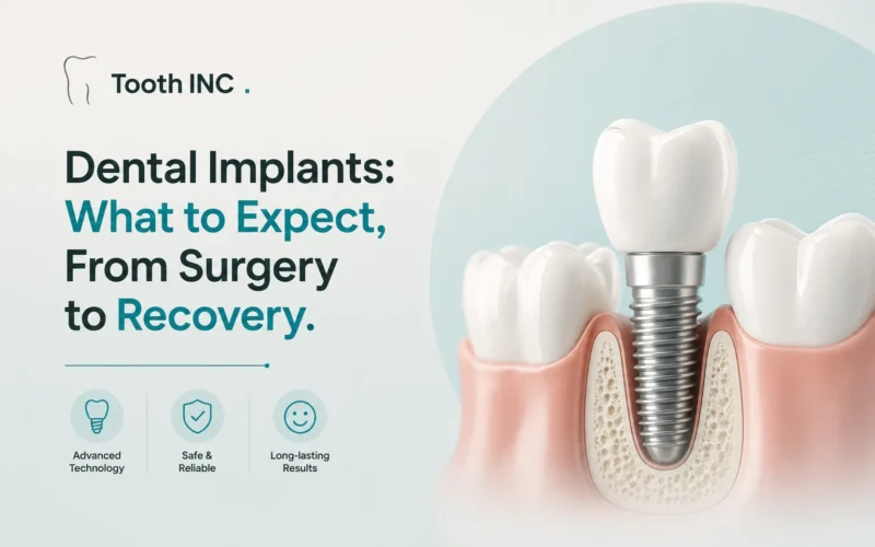 Dental Implants Chandigarh