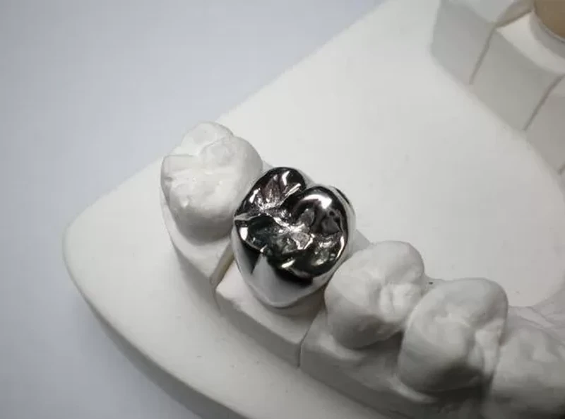 PFM Crowns