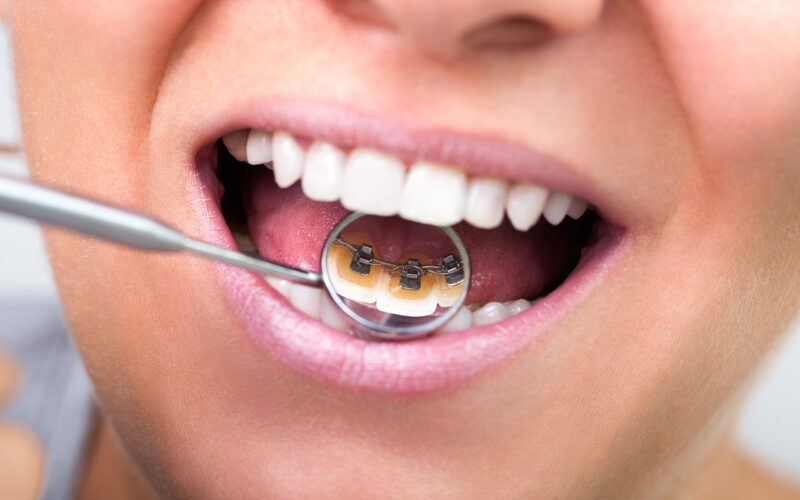 Services 22 Dental Check