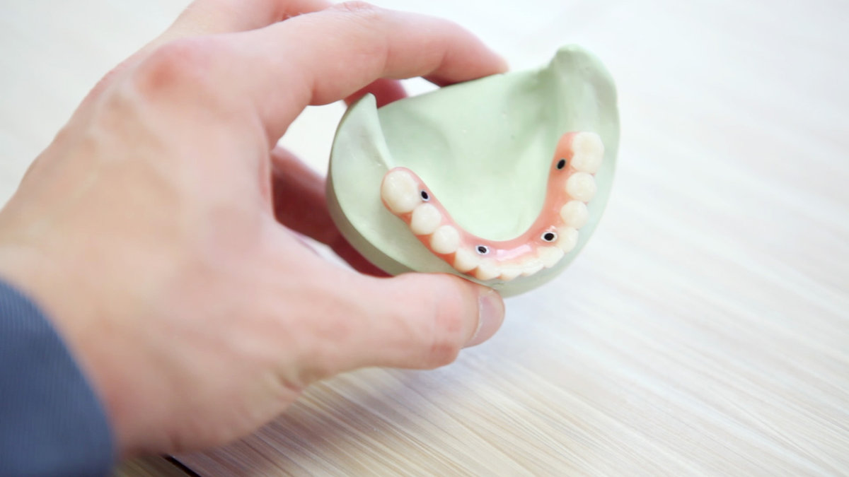 Implant-Supported Dentures