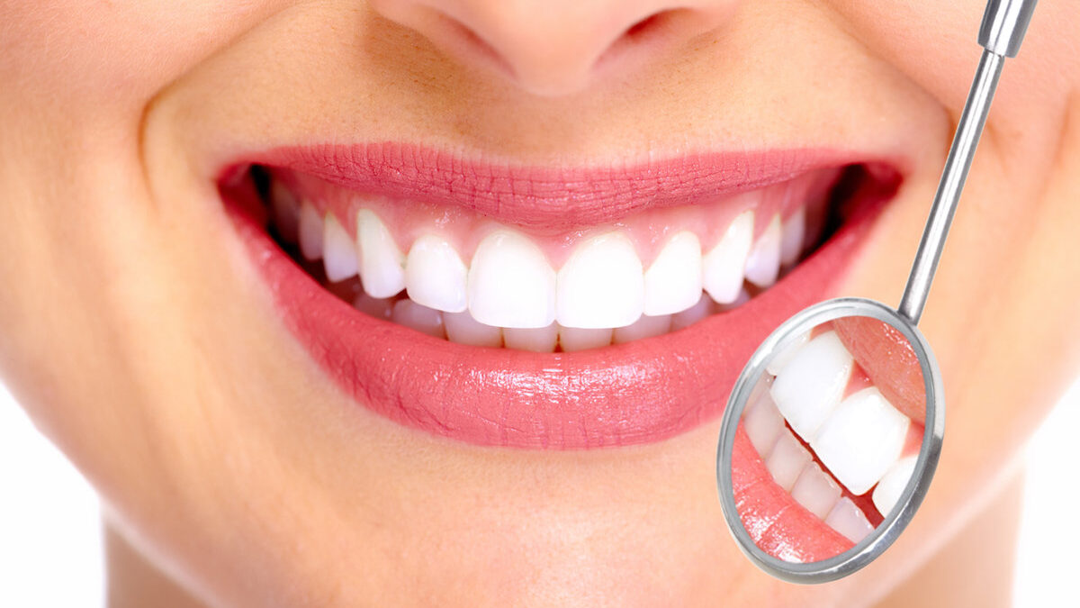 Teeth Whitening