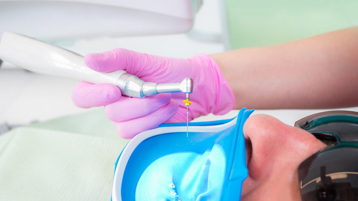Root Canal Treatment