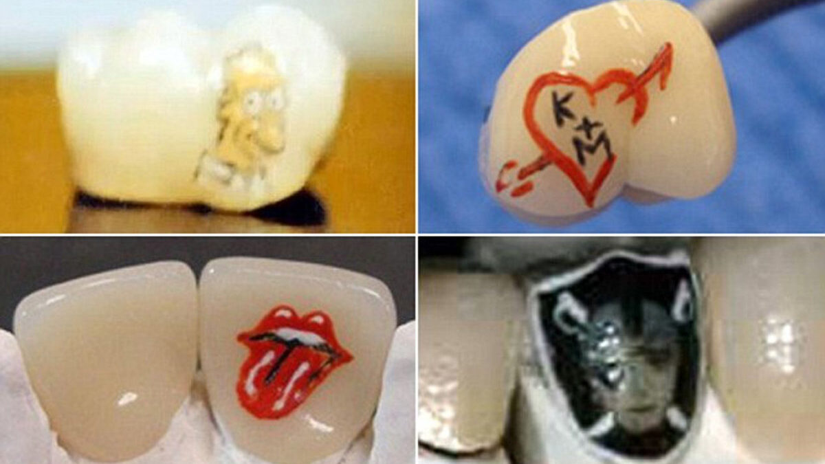 Tooth Tattoos
