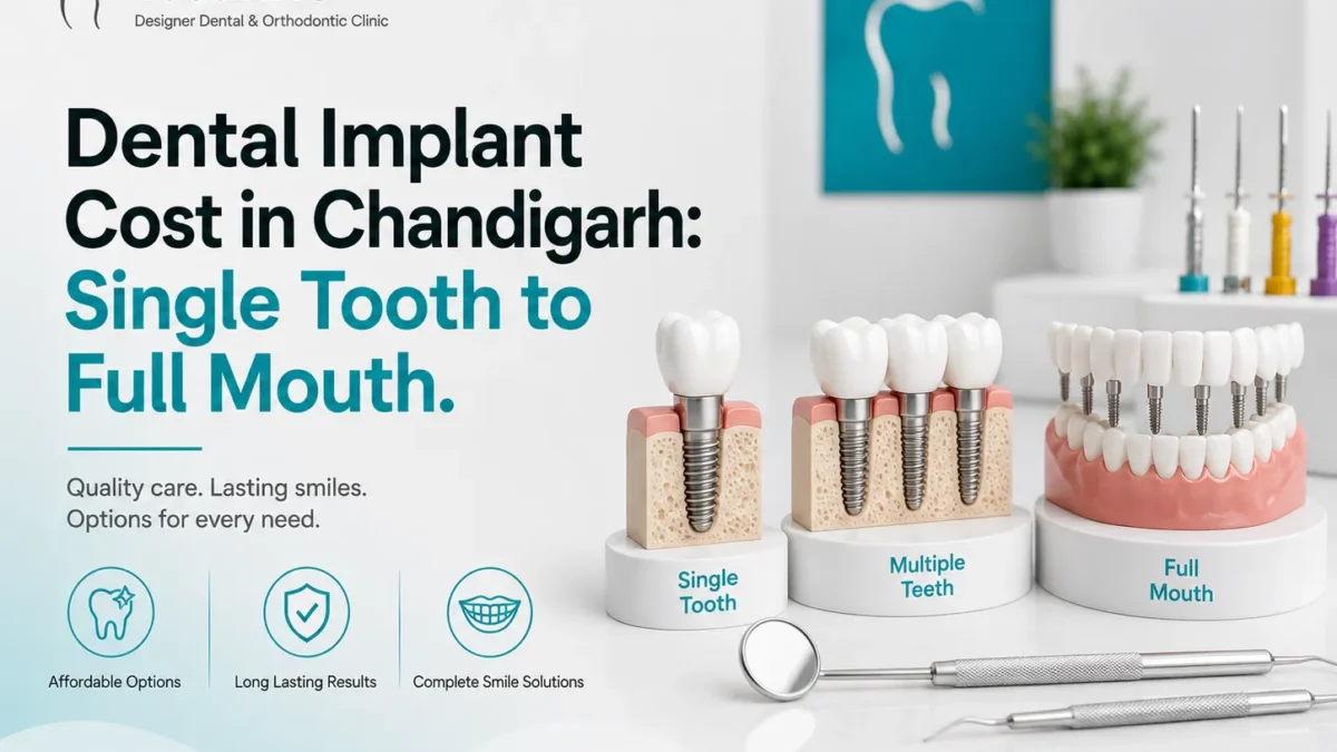Dental Implant Chandigarh