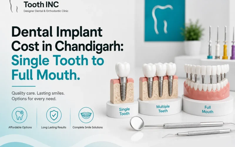 Dental Implant Chandigarh