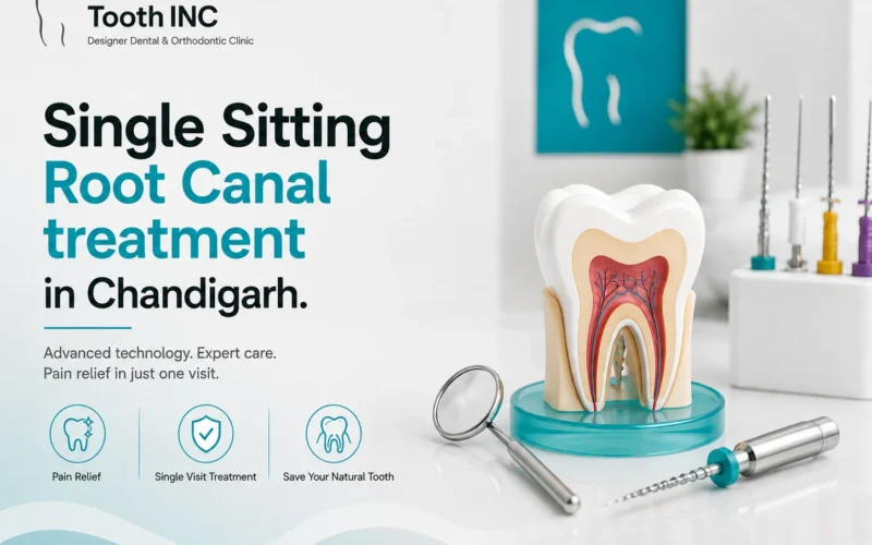 Single Sitting Root Canal treatment in Chandigarh 2 Root Canal Treatment Chandigarh