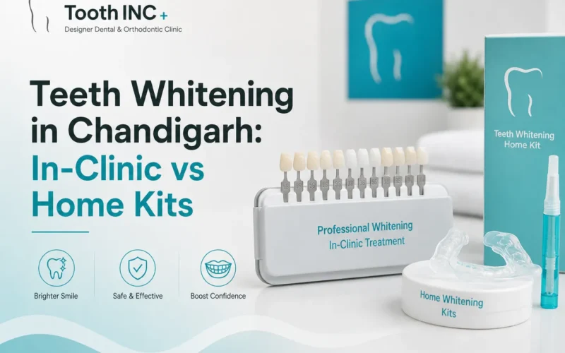 Teeth Whitening Chandigarh