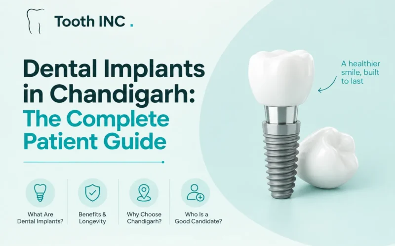 Dental Implants Chandigarh