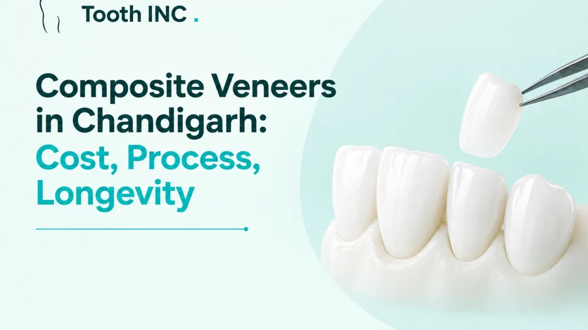 Composite Veneers in Chandigarh